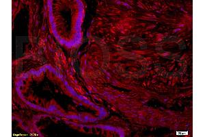 Formalin-fixed and paraffin embedded human placenta tissue labeled with  (ABIN725960)  Rabbit Anti-Nociceptin receptor Polyclonal Antibody at 1: 200 followed by incubation with conjugated secondary antibody and DAB staining. (OPRL1 antibody  (AA 1-47))