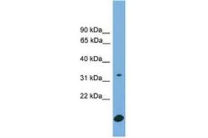 Image no. 1 for anti-RAB9A, Member RAS Oncogene Family (RAB9A) (AA 71-120) antibody (ABIN6744819) (RAB9A antibody  (AA 71-120))