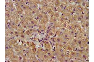 Immunohistochemistry (IHC) image for anti-Aldehyde Dehydrogenase 7 Family, Member A1 (ALDH7A1) (AA 386-515) antibody (ABIN7143836)