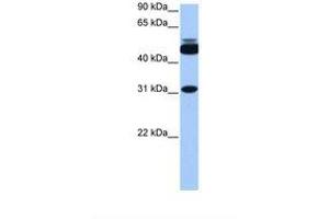 Image no. 1 for anti-Cylicin, Basic Protein of Sperm Head Cytoskeleton 2 (CYLC2) (C-Term) antibody (ABIN6738858) (CYLC2 antibody  (C-Term))