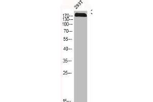 Western Blot analysis of 293T cells using CFTR Polyclonal Antibody (CFTR antibody)