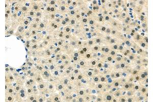 ABIN6263252 and ABIN6279536 at 1/100 staining Rat liver tissue by IHC-P.