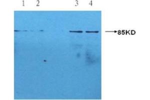 Western blotting using Mouse anti-human CRP monoclonal antibody (S5G1) at 1:1000 dilution. (CRP antibody)