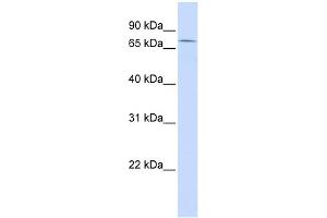 WB Suggested Anti-ZNF442 Antibody Titration: 0. (ZNF442 antibody  (Middle Region))