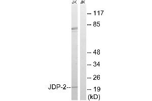Western blot analysis of extracts from Jurkat cells, using JDP-2 (Ab-148) antibody.