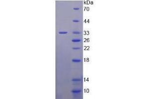 Image no. 1 for Phosphoinositide-3-Kinase, Class 3 (PIK3C3) (AA 631-885) protein (His tag) (ABIN6238077)