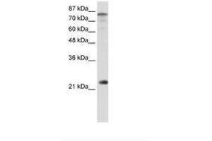 Image no. 1 for anti-Nuclear Transcription Factor Y, beta (NFYB) (N-Term) antibody (ABIN6736220) (NFYB antibody  (N-Term))