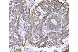 IHC analysis of ATX2/ATXN2 using anti-ATX2/ATXN2 antibody (ABIN3043507). (Ataxin 2 antibody  (C-Term))
