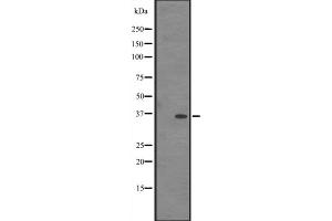 Western blot analysis of IN35 expression in HEK293 cells ,The lane on the left is treated with the antigen-specific peptide. (IFI35 antibody  (C-Term))