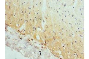 Immunohistochemistry of paraffin-embedded human heart tissue using ABIN7144362 at dilution of 1:100 (AP2A2 antibody  (AA 590-939))