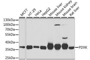 Western blot analysis of extracts of various cell lines, using PDXK antibody. (PDXK antibody  (AA 1-312))