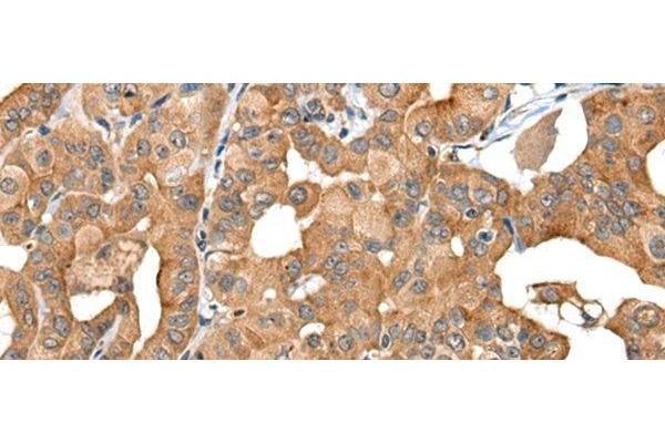 INF2 antibody