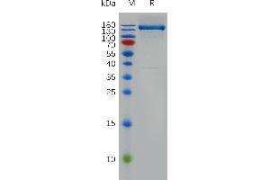 SDS-PAGE (SDS) image for Fms-Related tyrosine Kinase 1 (VEGFR1) (FLT1) (AA 27-756) protein (Fc Tag) (ABIN6964344)