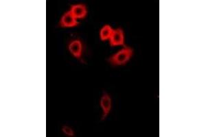 Immunofluorescent analysis of GalNAc-T2 staining in Hela cells. (GalNAc-T2 antibody)