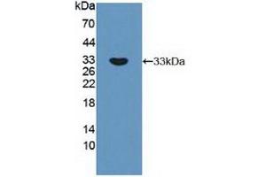 Detection of Recombinant RPS6Kb1, Human using Polyclonal Antibody to Ribosomal Protein S6 Kinase Beta 1 (RPS6Kb1) (RPS6KB1 antibody  (AA 91-352))