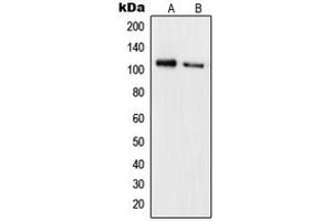 Western blot analysis of RB1 (pS780) expression in Jurkat FBS-treated (A), HeLa (B) whole cell lysates. (Retinoblastoma 1 antibody  (C-Term, pSer780))