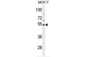 CES2 Antibody (Center) western blot analysis in MCF-7 cell line lysates (35µg/lane). (CES2 antibody  (Middle Region))