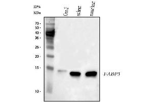 Western blot analysis of Cardiac FABP using anti-Cardiac FABP antibody (ABIN5693024).