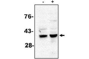 Western Blotting (WB) image for anti-Caspase 7, Apoptosis-Related Cysteine Peptidase (CASP7) antibody (ABIN264418)