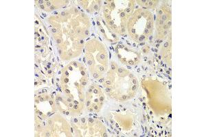 Immunohistochemistry of paraffin-embedded human kidney using UBE2Z antibody at dilution of 1:100 (40x lens). (UBE2Z antibody)