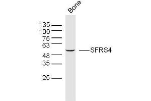 Mouse bone lysates probed with SFRS4 Polyclonal Antibody, Unconjugated  at 1:300 overnight at 4˚C.