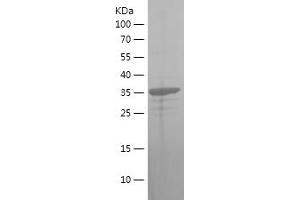 Western Blotting (WB) image for Hydroxysteroid (17-Beta) Dehydrogenase 10 (HSD17B10) (AA 43-146) protein (His-IF2DI Tag) (ABIN7123386) (HSD17B10 Protein (AA 43-146) (His-IF2DI Tag))