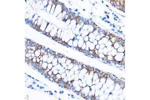 Immunohistochemistry of paraffin-embedded Human colon using C Rabbit pAb (ABIN7266006) at dilution of 1:50 (40x lens). (CABP1 antibody)