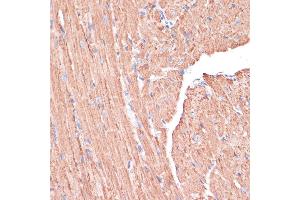 Immunohistochemistry (IHC) image for anti-Phosphogluconate Dehydrogenase (PGD) (AA 184-483) antibody (ABIN6145502)