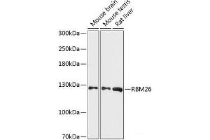 Western blot analysis of extracts of various cell lines using RBM26 Polyclonal Antibody at dilution of 1:3000. (RBM26 antibody)