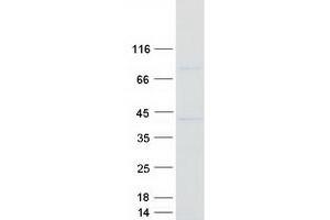 Validation with Western Blot (CAPZA2 Protein (Myc-DYKDDDDK Tag))