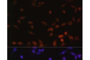 Immunofluorescence analysis of NIH/3T3 cells using ZEB2 Polyclonal Antibody at dilution of 1:100. (ZEB2 antibody)
