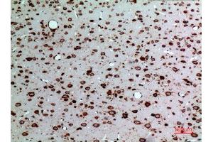Immunohistochemistry (IHC) analysis of paraffin-embedded Rat Brain, antibody was diluted at 1:100. (Midkine antibody  (Internal Region))