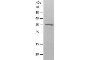 BDNF Protein (AA 129-247) (His-IF2DI Tag)