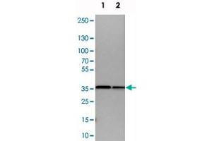 Western blot analysis of cell lysates with ARPC1B polyclonal antibody . (ARPC1B antibody)