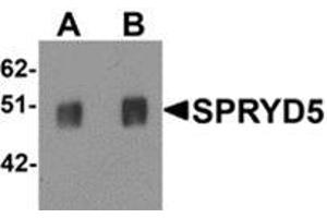 Western blot analysis of SPRYD5 in rat brain tissue lysate with SPRYD5 antibody at (A) 0. (TRIM51 antibody  (C-Term))
