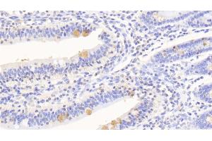 Detection of SERPINA10 in Human Small intestine Tissue using Polyclonal Antibody to Serpin A10 (SERPINA10) (SERPINA10 antibody  (AA 24-444))
