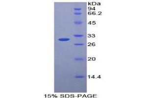 SDS-PAGE analysis of Mouse Protease, Serine 12 Protein. (Protease Protein)