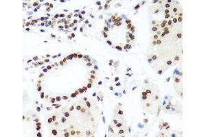 Immunohistochemistry of paraffin-embedded Human stomach using Histone H2AX Polyclonal Antibody at dilution of 1:100 (40x lens). (H2AFX antibody)