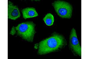 A549 cells were stained with HDAC4 (6B10) Monoclonal Antibody  at [1:200] incubated overnight at 4C, followed by secondary antibody incubation, DAPI staining of the nuclei and detection. (HDAC4 antibody)