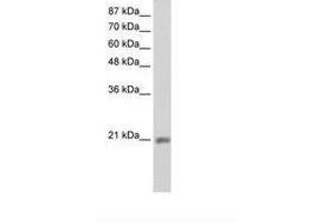 Image no. 1 for anti-MIF4G Domain Containing (MIF4GD) (C-Term) antibody (ABIN202129) (MIF4GD antibody  (C-Term))