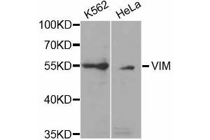 Western blot analysis of extracts of various cell lines, using VIM antibody (ABIN5971408) at 1/1000 dilution. (Vimentin antibody)