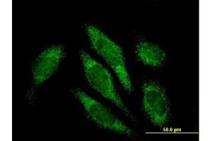 Immunofluorescence of purified MaxPab antibody to ALDH16A1 on HeLa cell. (ALDH16A1 antibody  (AA 1-802))