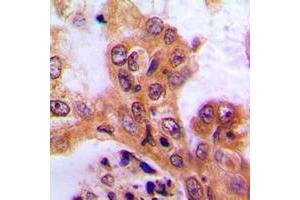 Immunohistochemistry (IHC) image for anti-serum/glucocorticoid Regulated Kinase 1 (SGK1) (Center) antibody (ABIN7301276)
