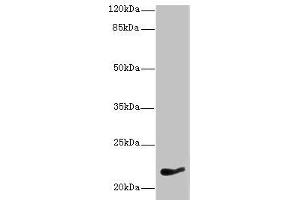 Western blot All lanes: NKIRAS1 antibody at 7 μg/mL + HepG2 whole cell lysate Secondary Goat polyclonal to rabbit IgG at 1/10000 dilution Predicted band size: 22 kDa Observed band size: 22 kDa (NKIRAS1 antibody  (AA 1-192))