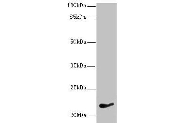 NKIRAS1 anticorps  (AA 1-192)