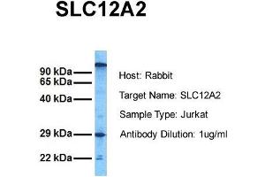 Host: Rabbit Target Name: SLC12A2 Sample Tissue: Human Jurkat Antibody Dilution: 1. (SLC12A2 antibody  (C-Term))