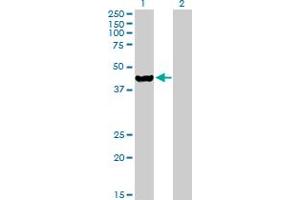 Western Blot analysis of ETNK2 expression in transfected 293T cell line by ETNK2 MaxPab polyclonal antibody. (Ethanolamine Kinase 2 antibody  (AA 1-386))