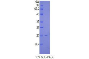 SDS-PAGE (SDS) image for Renalase, FAD-Dependent Amine Oxidase (RNLS) (AA 160-319) protein (His tag) (ABIN1080624)
