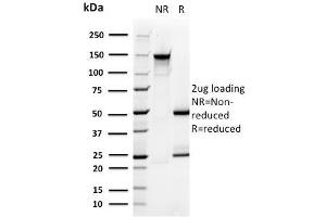 SDS-PAGE Analysis Purified PMEPA1 Mouse Monoclonal Antibody (PMEPA1/2696). (PMEPA1 antibody)