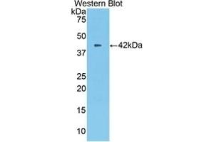 Detection of recombinant CPB2 using Polyclonal Antibody to Carboxypeptidase B2 (CPB2) (CPB2 antibody  (AA 113-422))